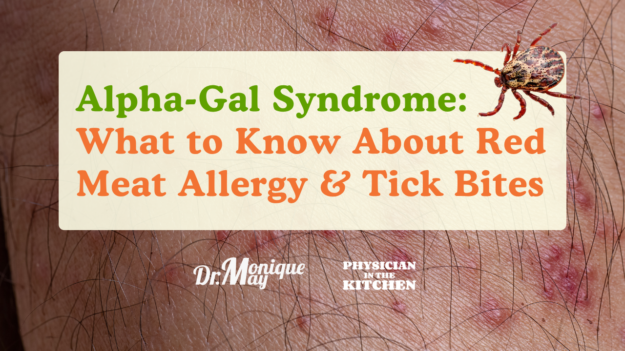 Alpha-Gal Syndrome What to Know About Red Meat Allergy & Tick Bites Alpha-Gal Syndrome: What to Know About Red Meat Allergy & Tick Bites